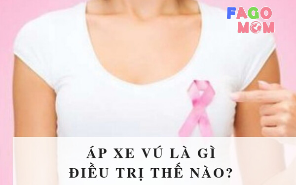 Áp xe vú sau sinh là gì?