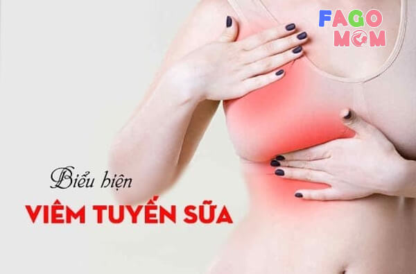 Biểu hiện của viêm tuyến vú
