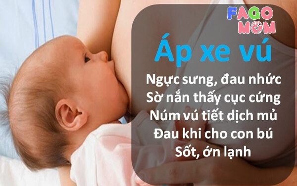 Dấu hiệu nhận biết tình trạng Áp xe vú