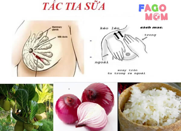 Một số bí kíp dân gian chữa tắc tia sữa tại nhà