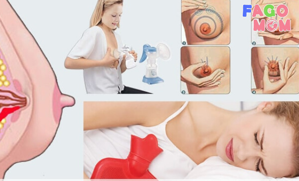 Lựa chọn phương pháp thông tắc tia sữa phù hợp nhất