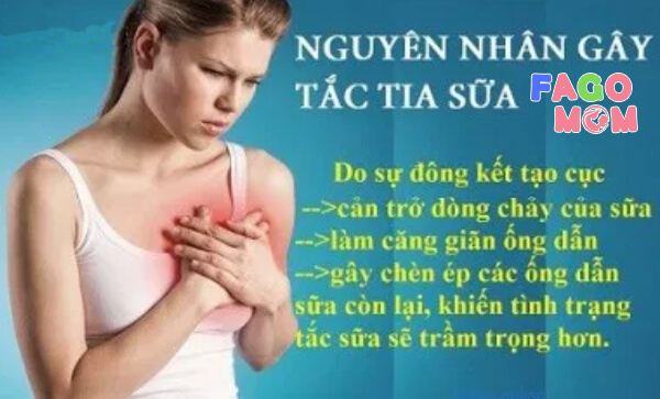 Nguyên nhân dẫn tới tình trạng bị tắc tia sữa