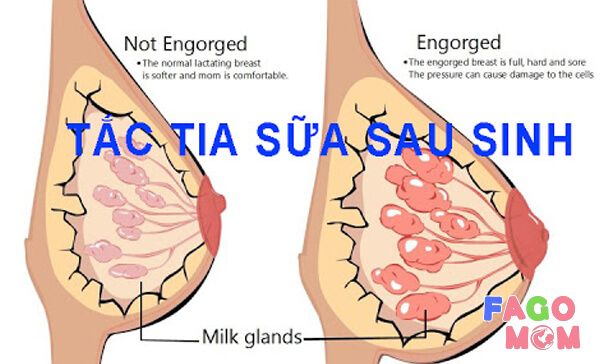 Tìm hiểu về tắc gia sữa nghĩa là gì