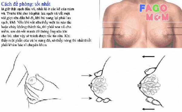 Cách phòng chống tình trạng tắc tia sữa ở phụ nữ