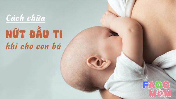 Cách điều trị tình trạng bị nứt đầu ti