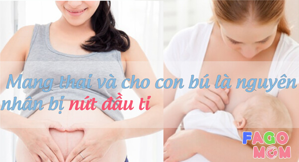 Nguyên nhân dẫn đến nứt đầu ti cho bé bú